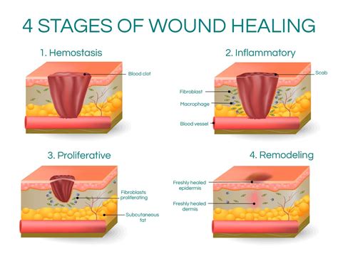 What are the 4 colors of wound healing?