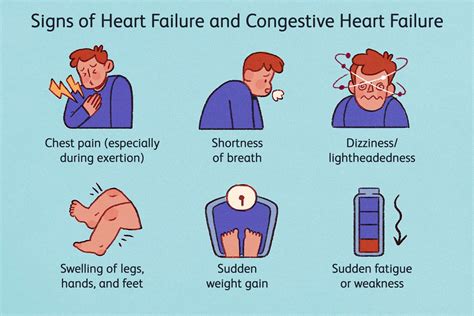 What are the 4 signs your heart is quietly failing?