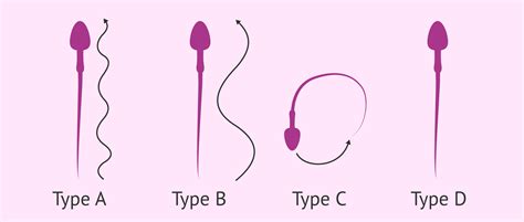 What are the 4 types of sperm?