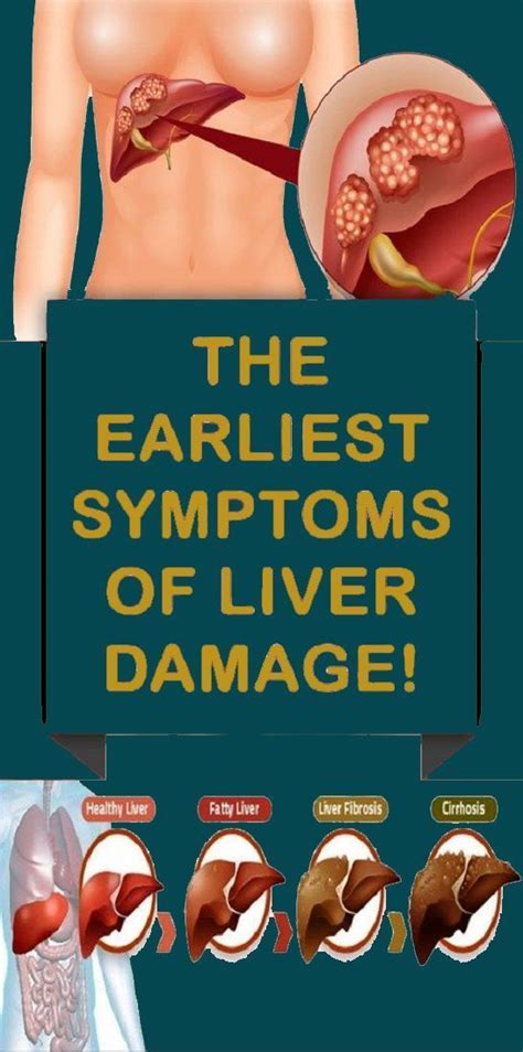 What are the 4 warning signs of a damaged liver?