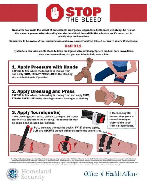 What are the 5 steps to follow to stop bleeding that you can see?