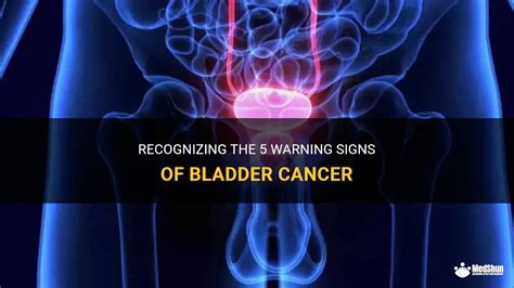 What are the 5 warning signs of bladder?