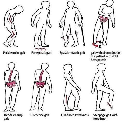 What are the 7 kinds of gait?