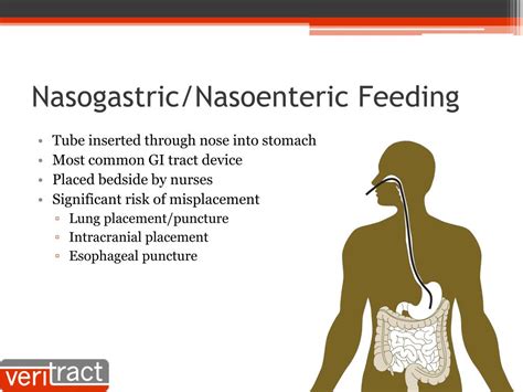 What are the advantages of nasogastric?