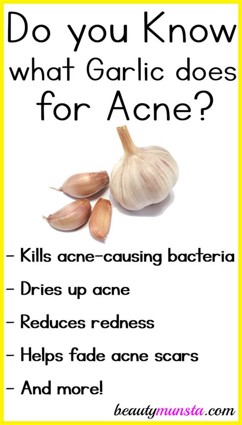 What are the benefits of acne?