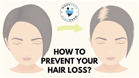 What are the big 3 to prevent hair loss?