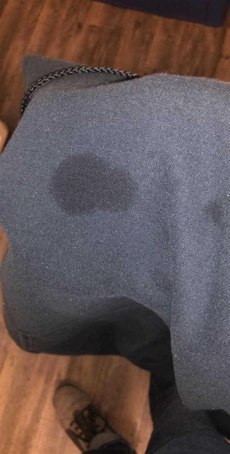 What are the black dots on my clothes?
