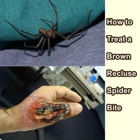 What are the chances of getting bitten by a spider?