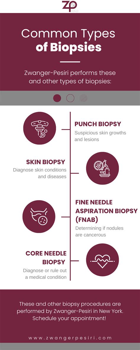 What are the different names of biopsies?