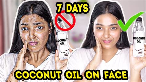 What are the disadvantages of applying coconut oil on face?