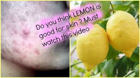 What are the disadvantages of lemon oil on skin?