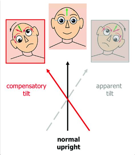 What are the effects of head tilt?