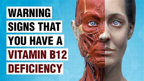 What are the facial signs of B12 deficiency?