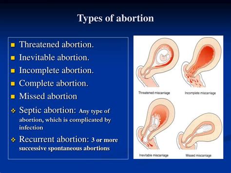 What are the features of a complete abortion?