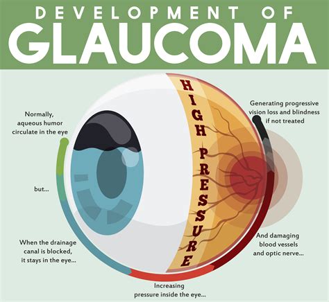 What are the first signs that glaucoma is developing?