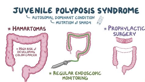 What are the genetic causes of juvenile polyps?