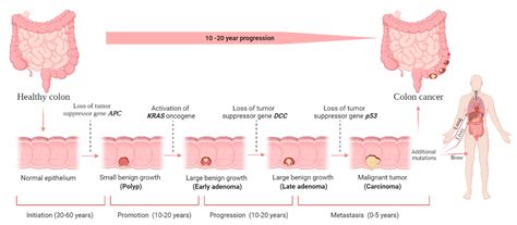 What are the genetic diseases of the colon?