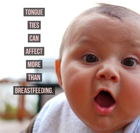 What are the long term effects of tongue-tie?
