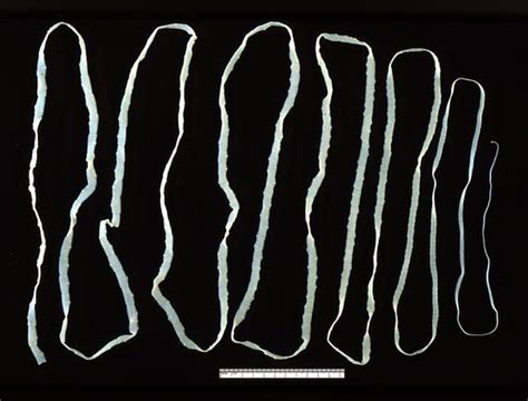 What are the odds of getting a tapeworm?