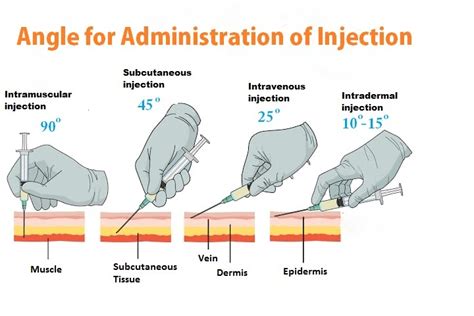 What are the principles of injection giving?