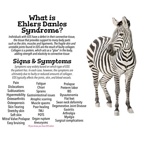 What are the red flags for Ehlers-Danlos syndrome?