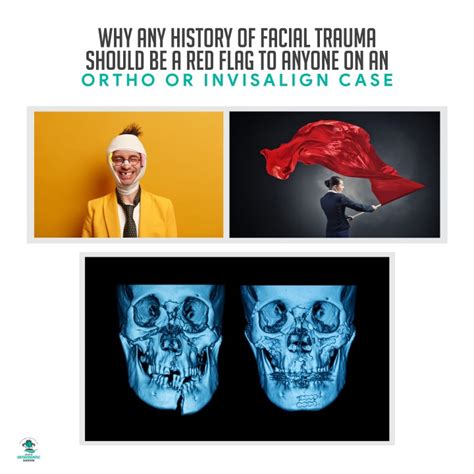 What are the red flags for facial trauma?