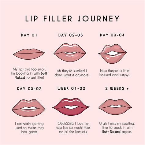 What are the rules after lip filler?