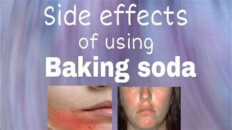 What are the side effects of baking soda hair removal?