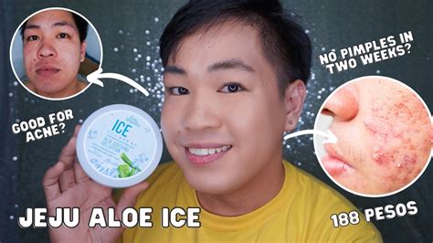 What are the side effects of ice gel?