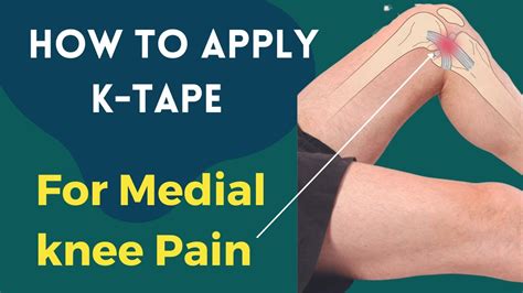 What are the side effects of taping?