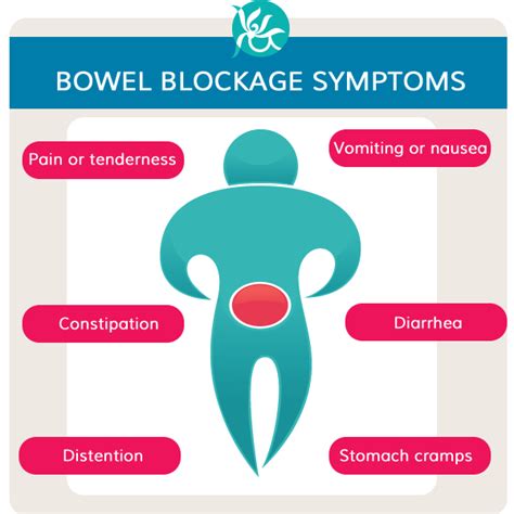 What are the signs of a blocked bowel?
