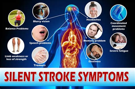 What are the signs of a silent stroke?