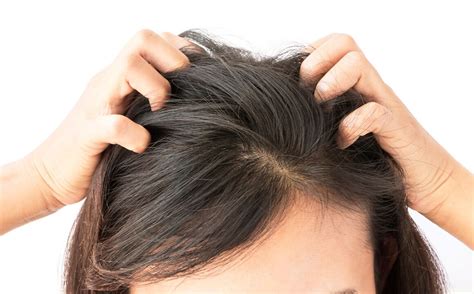 What are the signs of good scalp?