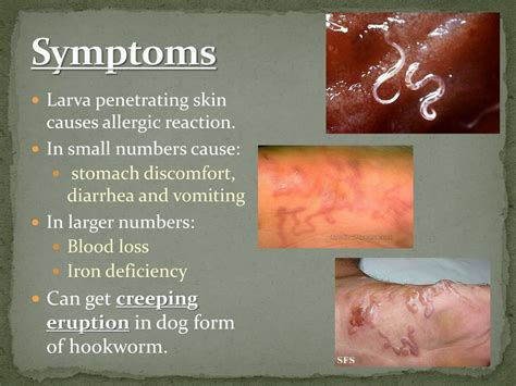 What are the skin symptoms of worms?