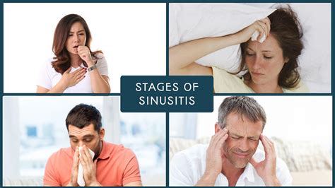 What are the stages of sinusitis?