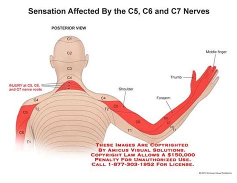 What are the symptoms of C5-C6 nerve damage?