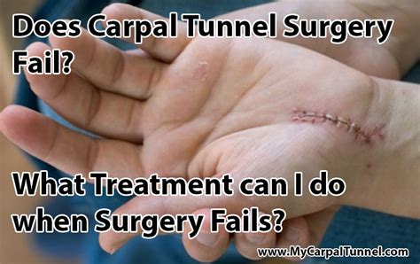 What are the symptoms of carpal tunnel surgery gone wrong?