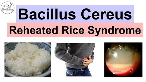 What are the symptoms of rice poisoning?