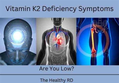 What are the symptoms of too much vitamin K2?
