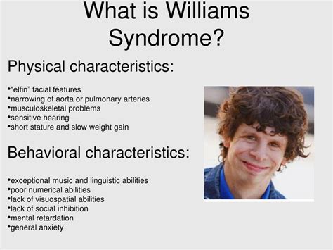 What are the weaknesses of Williams syndrome?