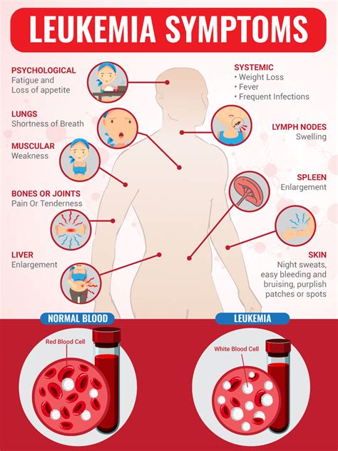 What are two late symptoms of leukemia?