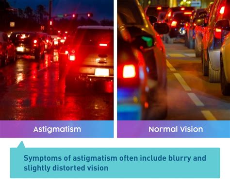 What astigmatism vision looks like?