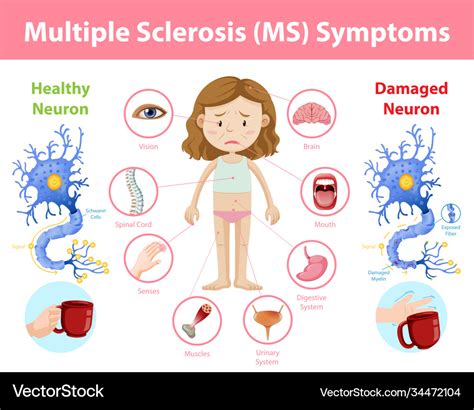 What autoimmune diseases mimic MS?