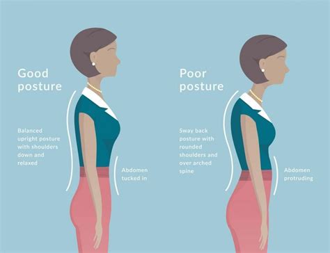 What bad posture looks like?