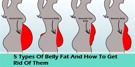 What body shape has a big belly?