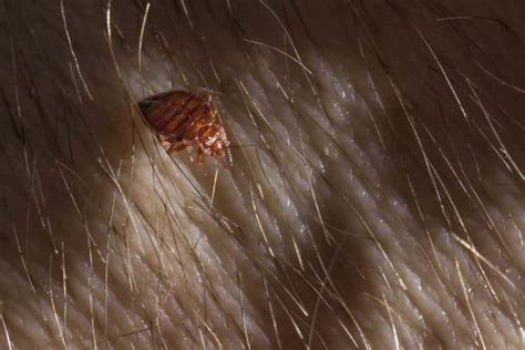 What bugs live in your hair but not lice?