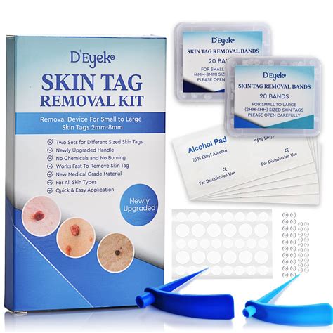 What can I buy to remove skin tags?