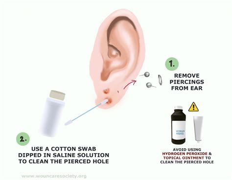 What can I put on an infected ear piercing?