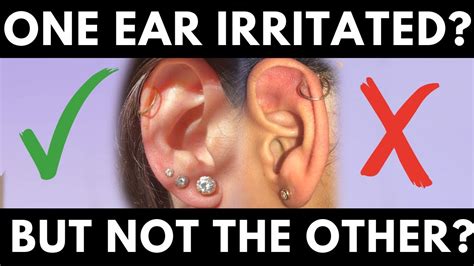 What can I put on an irritated piercing?