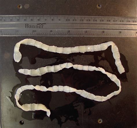 What can be mistaken for tapeworm segments?